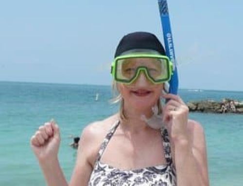 Alopecia and Beach Holidays: How to Enjoy the Sun and Water with Confidence